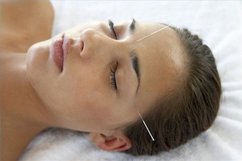 Hvordan Heal Acne Med Akupunktur