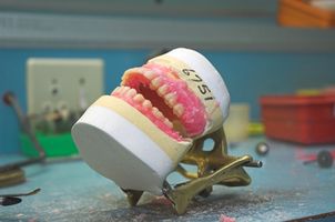 Hvordan kan jeg måle for tannimplantater gjøre?