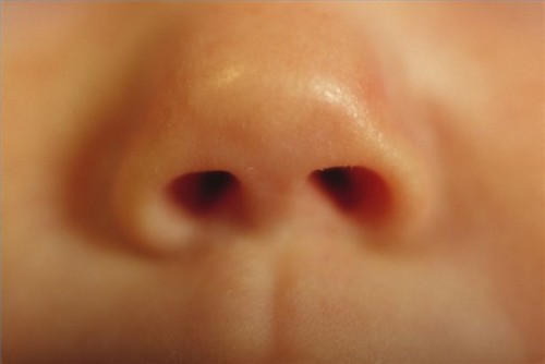 Hvordan suge en babyens nese