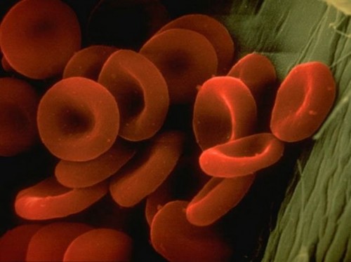 Hvordan identifisere røde blodceller autoimmune sykdommer