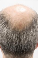 Hvordan veksten av hår påvirkes av faktorer knyttet til aldring
