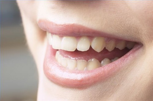 Hvordan å oppdage og forhindre periodontal tannkjøttsykdom