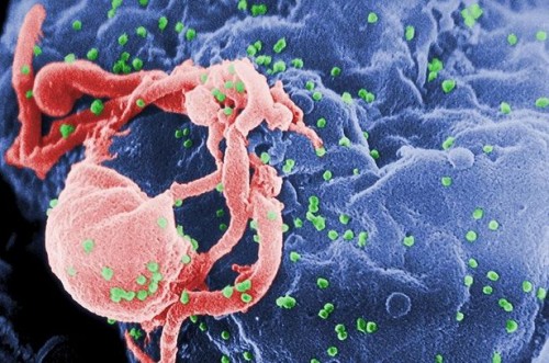 Sluttfasen av fullt utviklet AIDS