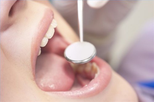 Hvordan bruke Dental tetningsmidler å forebygge hull