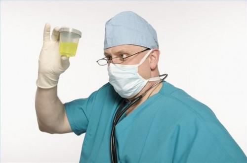 Hvordan bruke urin for å kurere sopp