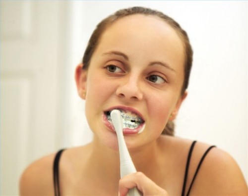 Hvordan å pusse tennene mens iført seler