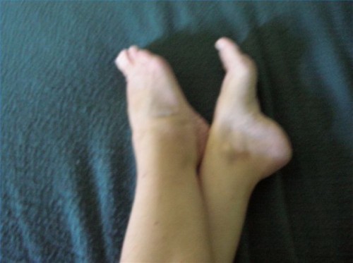 Urter som hjelper med Restless Legs Syndrome