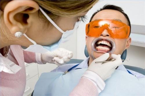 Hvordan å sammenligne tennene bleking med Dental veneers