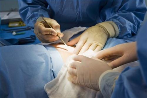 Hvordan forberede for herniated disk kirurgi
