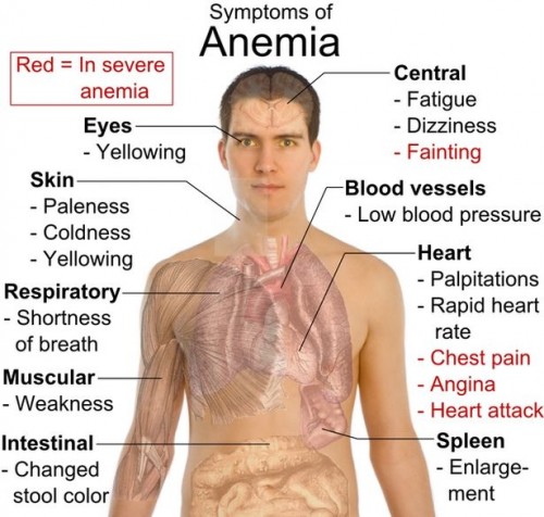 Symptomer på anemi hos voksne