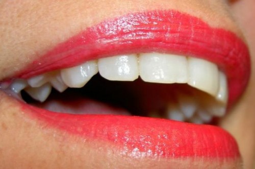Informasjon om zoom Teeth Whitening