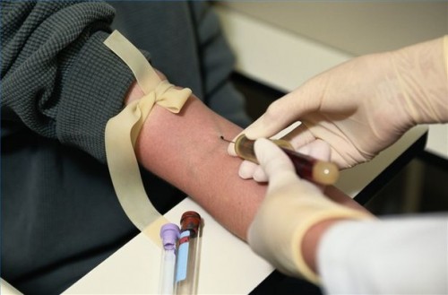 Hvordan diagnostisere laktasemangel Med en blodprøve