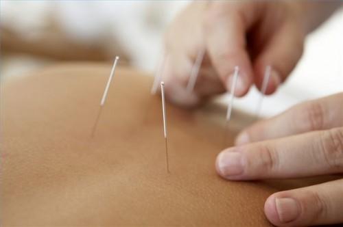 Hvordan avlaste skulder smerter Gjennom Akupunktur